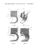 Stabilized Spinal Fixation Device diagram and image