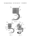 Stabilized Spinal Fixation Device diagram and image