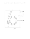 Stabilized Spinal Fixation Device diagram and image