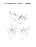 System and Method of Soft Tissue Anchoring to Metaphyseal Bone Plate diagram and image