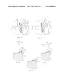 System and Method of Soft Tissue Anchoring to Metaphyseal Bone Plate diagram and image