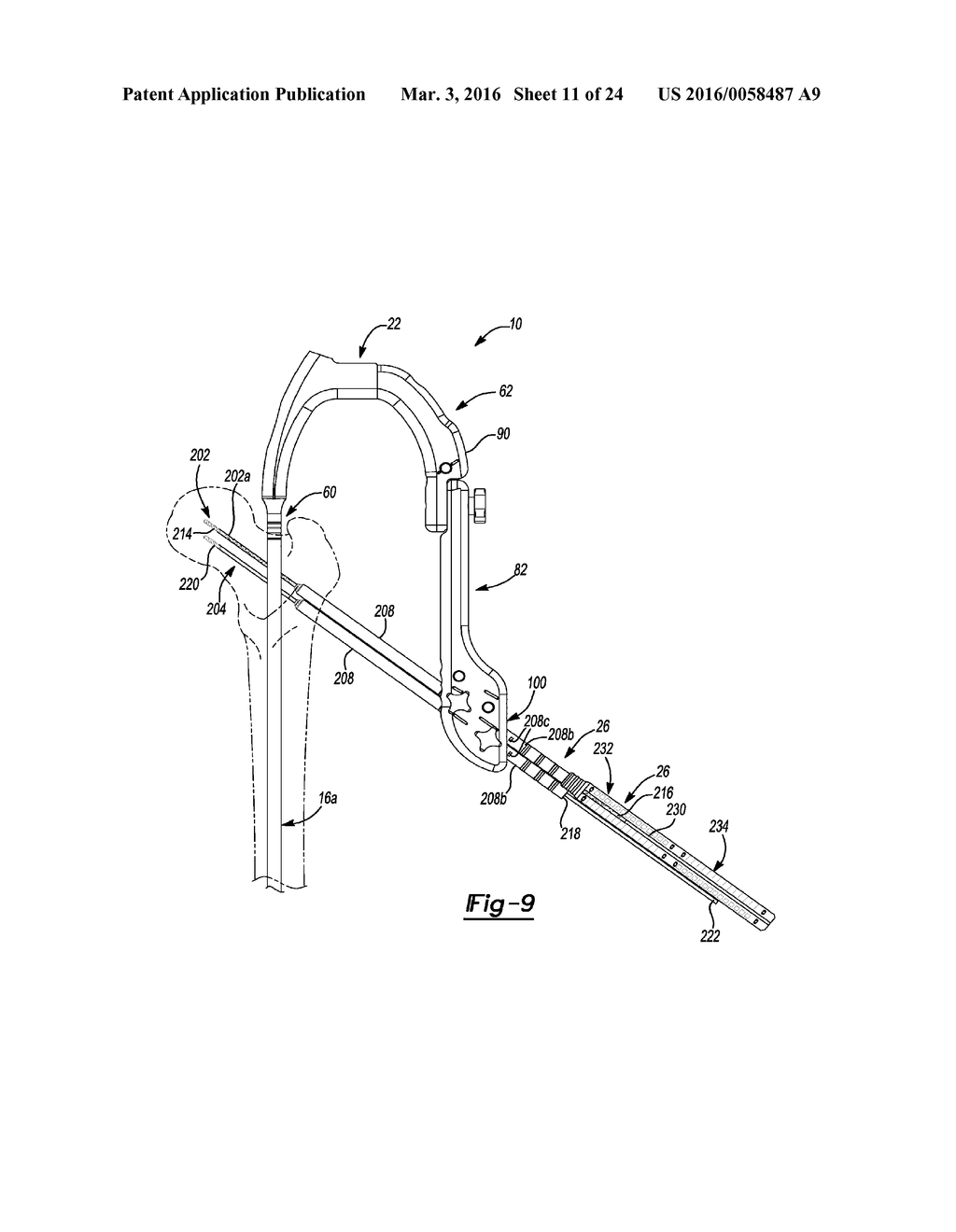 METHOD AND APPARATUS FOR ORTHOPEDIC FIXATION - diagram, schematic, and image 12