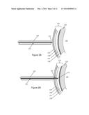 Electrosurgical Pericardial Puncture diagram and image