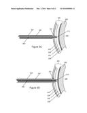 Electrosurgical Pericardial Puncture diagram and image