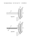 Electrosurgical Pericardial Puncture diagram and image