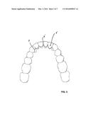 RETAINER AND METHOD FOR PRODUCTION THEREOF diagram and image