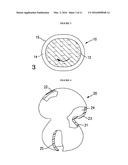 RESILIENT MEDICALLY INFLATABLE INTERPOSITIONAL ARTHROPLASTY DEVICE diagram and image