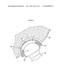 RESILIENT MEDICALLY INFLATABLE INTERPOSITIONAL ARTHROPLASTY DEVICE diagram and image