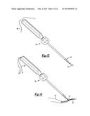 KNOTLESS GRAFT FIXATION ASSEMBLY diagram and image