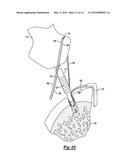 KNOTLESS GRAFT FIXATION ASSEMBLY diagram and image