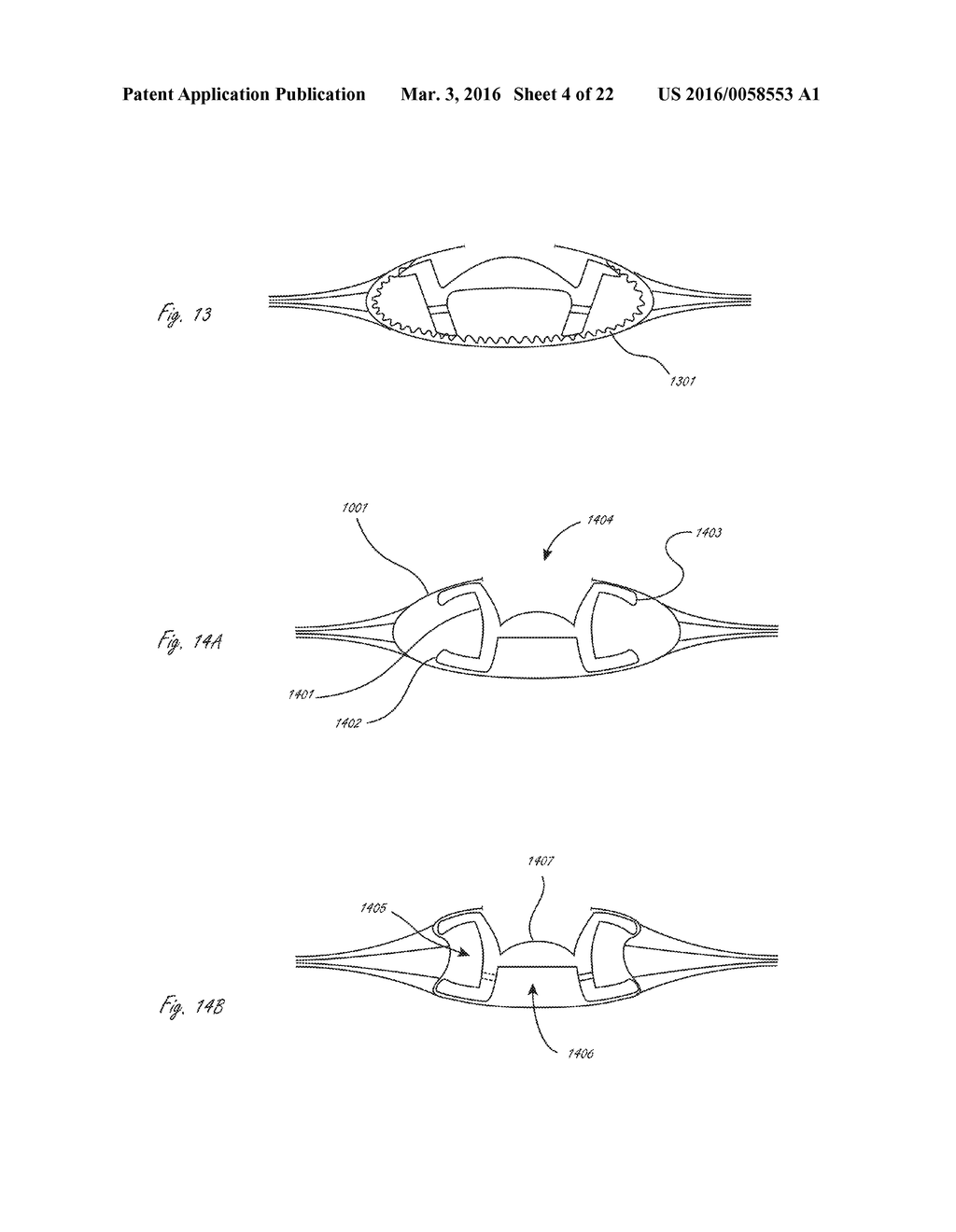 ACCOMMODATING INTRAOCULAR LENS - diagram, schematic, and image 05