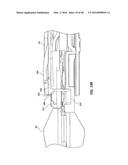 ADVANCED PUSHROD AND PUSHROD ASSEMBLY FEATURES diagram and image