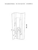 ADVANCED PUSHROD AND PUSHROD ASSEMBLY FEATURES diagram and image