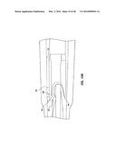 ADVANCED PUSHROD AND PUSHROD ASSEMBLY FEATURES diagram and image