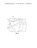 ADVANCED PUSHROD AND PUSHROD ASSEMBLY FEATURES diagram and image