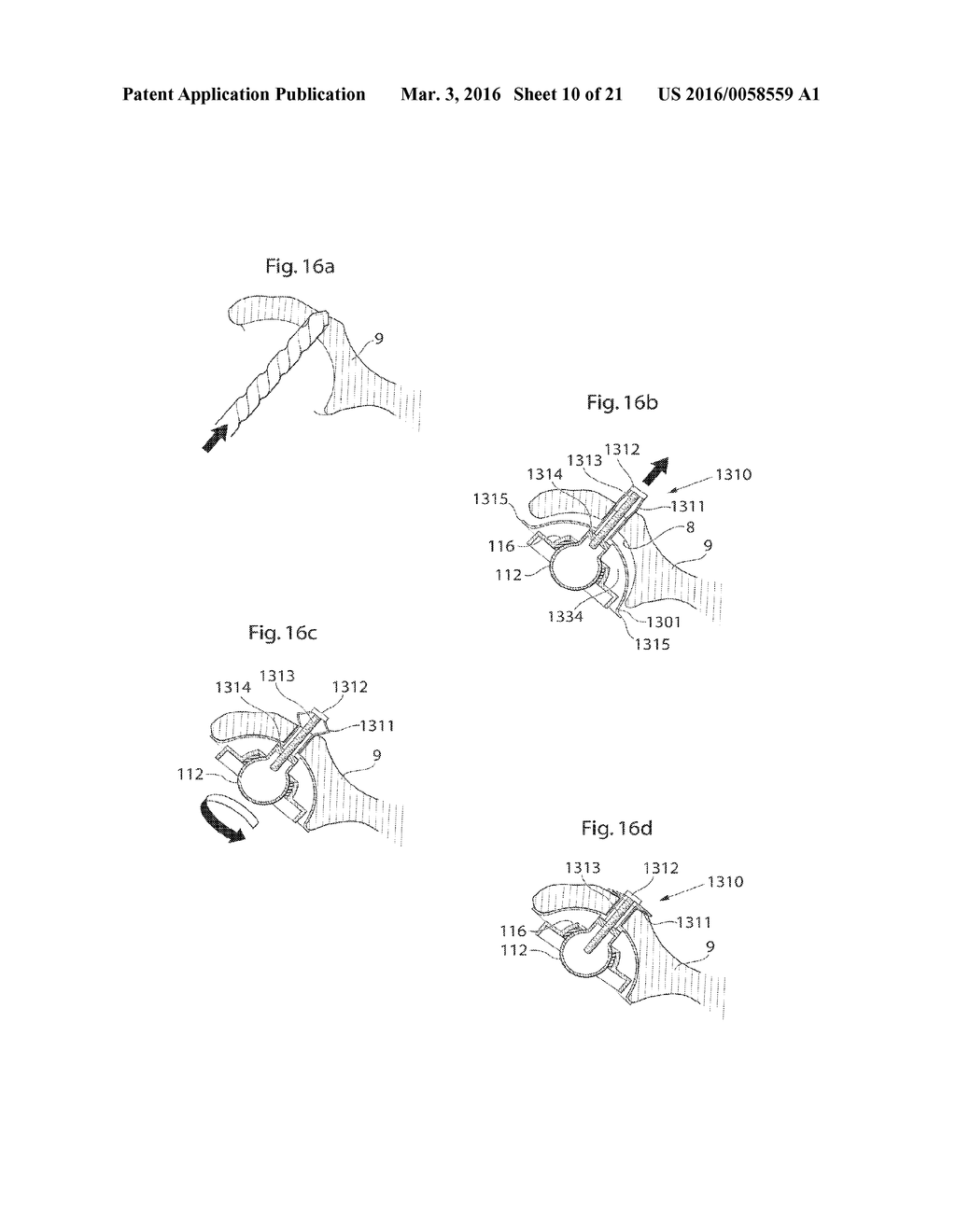 HIP JOINT DEVICE AND METHOD - diagram, schematic, and image 11