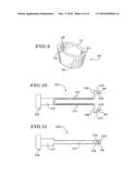 TIBIAL AUGMENTS FOR USE WITH KNEE JOINT PROSTHESES, METHOD OF IMPLANTING     THE TIBIAL AUGMENT, AND ASSOCIATED TOOLS diagram and image