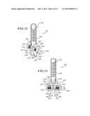 TIBIAL AUGMENTS FOR USE WITH KNEE JOINT PROSTHESES, METHOD OF IMPLANTING     THE TIBIAL AUGMENT, AND ASSOCIATED TOOLS diagram and image