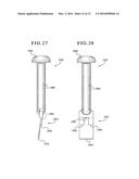 TIBIAL AUGMENTS FOR USE WITH KNEE JOINT PROSTHESES, METHOD OF IMPLANTING     THE TIBIAL AUGMENT, AND ASSOCIATED TOOLS diagram and image