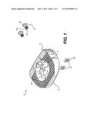 Intervertebral Implants and Related Methods of Use diagram and image