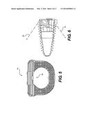 Intervertebral Implants and Related Methods of Use diagram and image