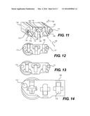 Intervertebral Implants and Related Methods of Use diagram and image