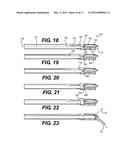 Intervertebral Implants and Related Methods of Use diagram and image