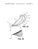 Intervertebral Implants and Related Methods of Use diagram and image