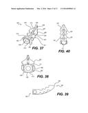 Intervertebral Implants and Related Methods of Use diagram and image