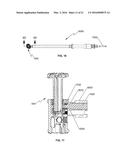 SPINAL FIXATION DEVICE diagram and image