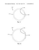 Dynamically Expandable Cannulae and Systems and Methods for Performing     Percutaneous Surgical Procedures Employing Same diagram and image