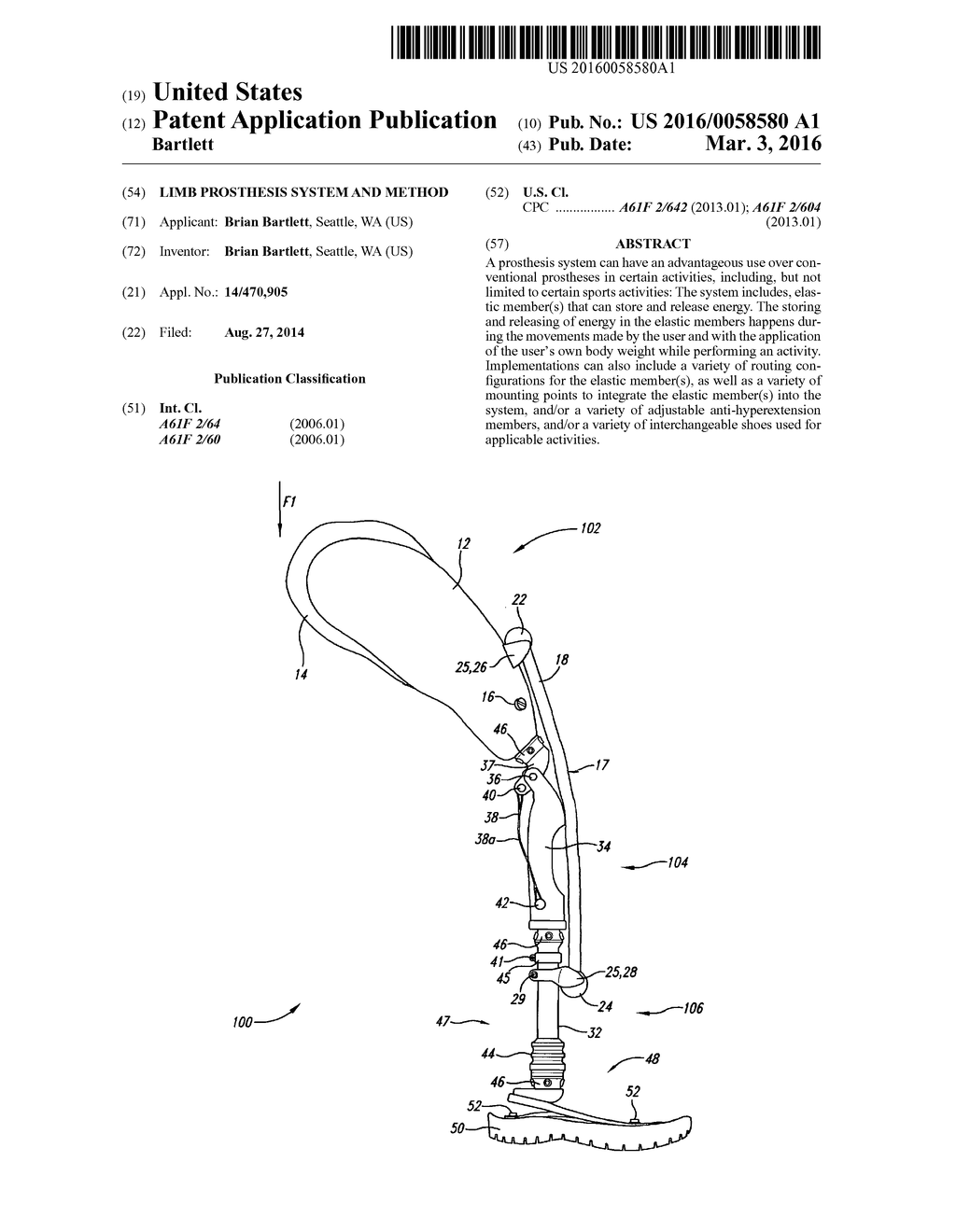 LIMB PROSTHESIS SYSTEM AND METHOD - diagram, schematic, and image 01