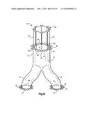 PERCUTANEOUS ENDOVASCULAR APPARATUS FOR REPAIR OF ANEURYSMS AND ARTERIAL     BLOCKAGES diagram and image