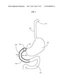 Gastrointestinal Device with Associated Commensal Microbes diagram and image