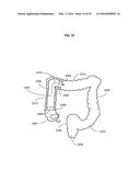 Gastrointestinal Device with Associated Commensal Microbes diagram and image