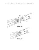 BARIATRIC CLAMP WITH SUTURE PORTIONS, MAGNETIC INSERTS AND CURVATURE diagram and image