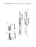 BARIATRIC CLAMP WITH SUTURE PORTIONS, MAGNETIC INSERTS AND CURVATURE diagram and image