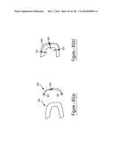 BARIATRIC CLAMP WITH SUTURE PORTIONS, MAGNETIC INSERTS AND CURVATURE diagram and image