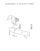 BARIATRIC CLAMP WITH SUTURE PORTIONS, MAGNETIC INSERTS AND CURVATURE diagram and image