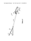 BARIATRIC CLAMP WITH SUTURE PORTIONS, MAGNETIC INSERTS AND CURVATURE diagram and image