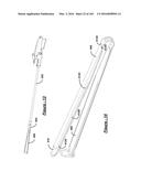 BARIATRIC CLAMP WITH SUTURE PORTIONS, MAGNETIC INSERTS AND CURVATURE diagram and image