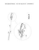 BARIATRIC CLAMP WITH SUTURE PORTIONS, MAGNETIC INSERTS AND CURVATURE diagram and image