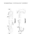 BARIATRIC CLAMP WITH SUTURE PORTIONS, MAGNETIC INSERTS AND CURVATURE diagram and image