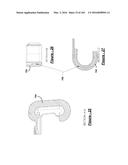 BARIATRIC CLAMP WITH SUTURE PORTIONS, MAGNETIC INSERTS AND CURVATURE diagram and image