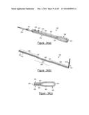 BARIATRIC CLAMP WITH SUTURE PORTIONS, MAGNETIC INSERTS AND CURVATURE diagram and image