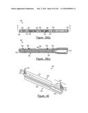 BARIATRIC CLAMP WITH SUTURE PORTIONS, MAGNETIC INSERTS AND CURVATURE diagram and image