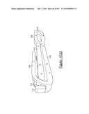 BARIATRIC CLAMP WITH SUTURE PORTIONS, MAGNETIC INSERTS AND CURVATURE diagram and image