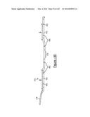 BARIATRIC CLAMP WITH SUTURE PORTIONS, MAGNETIC INSERTS AND CURVATURE diagram and image