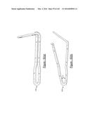 BARIATRIC CLAMP WITH SUTURE PORTIONS, MAGNETIC INSERTS AND CURVATURE diagram and image