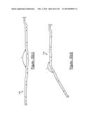 BARIATRIC CLAMP WITH SUTURE PORTIONS, MAGNETIC INSERTS AND CURVATURE diagram and image